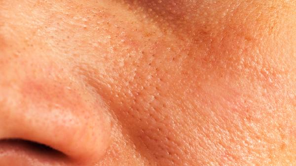 How Long Does Facial Fat Grafting Last? Find Out Here!