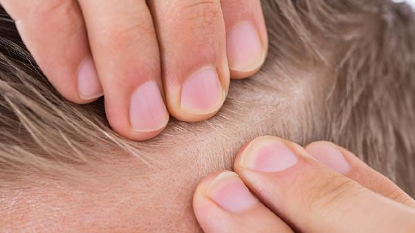 Best Haircare Tips for Managing Frizz and Tame Locks