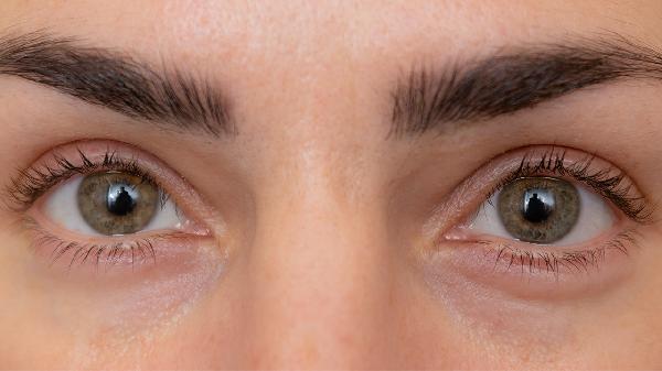 Banish Dark Circles: Tips for Night Owls to Refresh Your Look