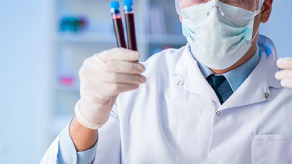 Preventing Lymphogranuloma Venereum: Essential Tips You Need to Know