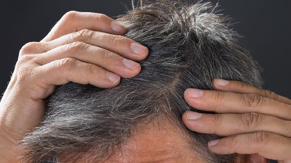 Can a lack of protein cause hair loss in men?