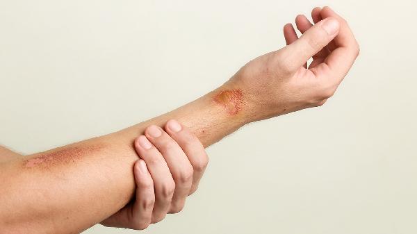 Top Arm Workouts for Building Muscle Fast