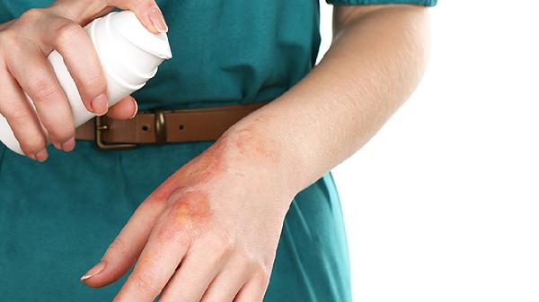 Spring Skin Allergies: Top Tips for Healthy Skin Care