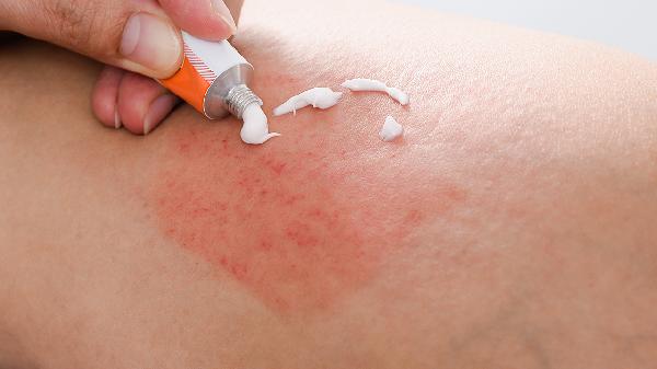 Why Your Washing Machine Could Be Triggering Skin Allergies