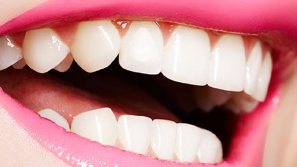Overdoing Teeth Whitening Can Harm Your Smile