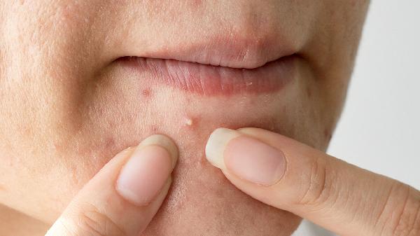 Pore Enlargement Causes: You're Missing This Crucial Step