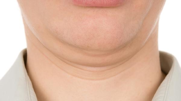 Easy Moves to Lose Double Chin and Get a V-Shaped Face Quickly