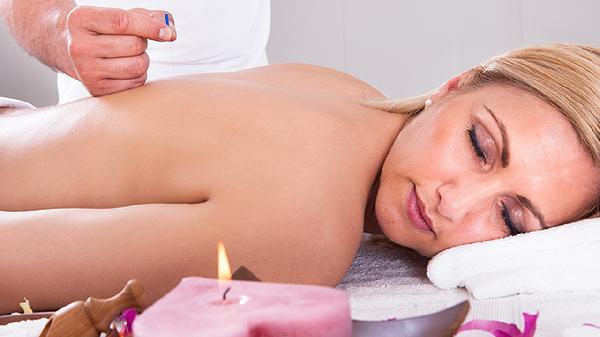 Can Acupuncture Boost Fertility? Experts Weigh In