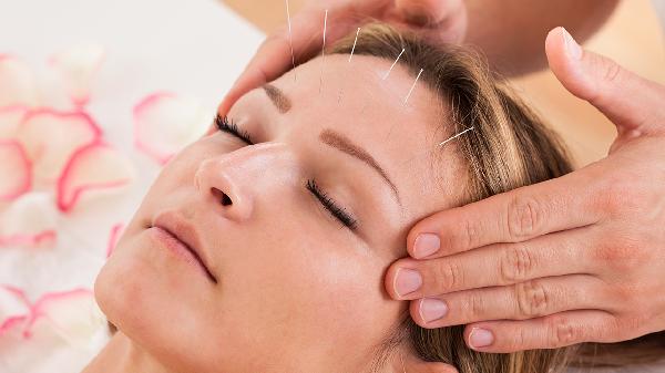 Is Acupuncture Covered by Insurance? Explained