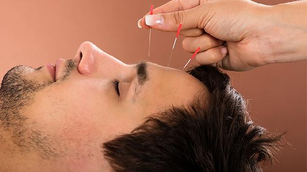 Looking for an Acupuncture Clinic Nearby?