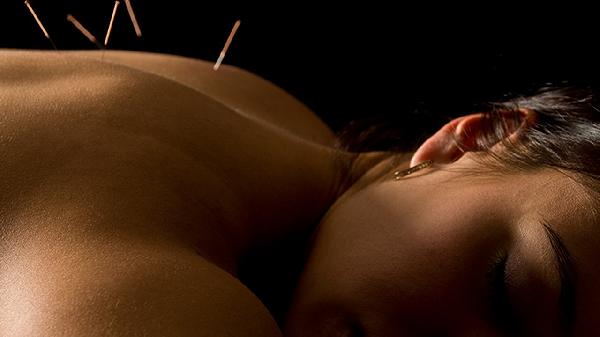 Can Acupuncture Help Induce Labor Naturally?