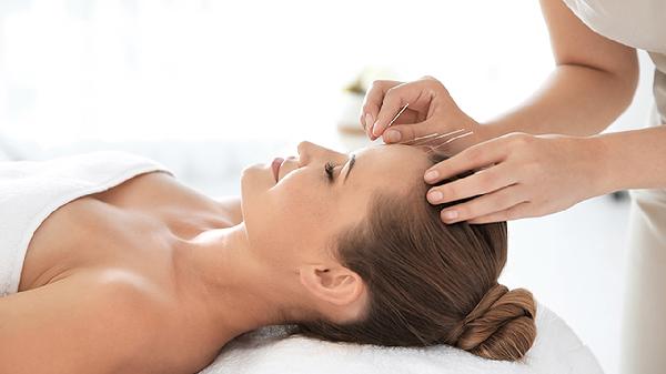Can Acupuncture Really Ease Anxiety? What You Need to Know