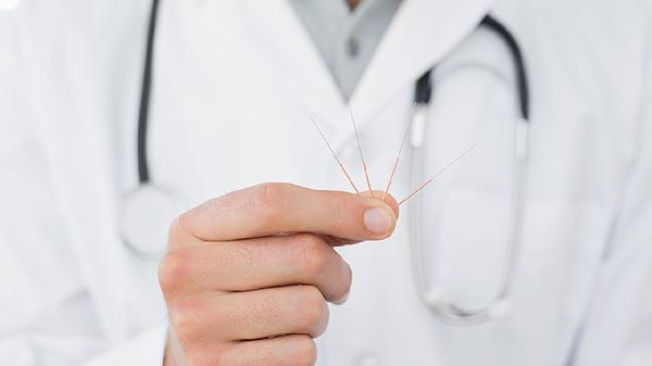 Where Can I Find Community Acupuncture Nearby?