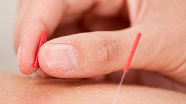 Where Are the Key Foot Acupuncture Points?
