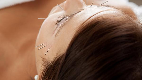 How Much Does Acupuncture Cost in the U.S.?