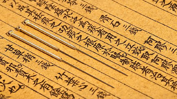 Dry Needling vs. Acupuncture: What’s the Real Difference?