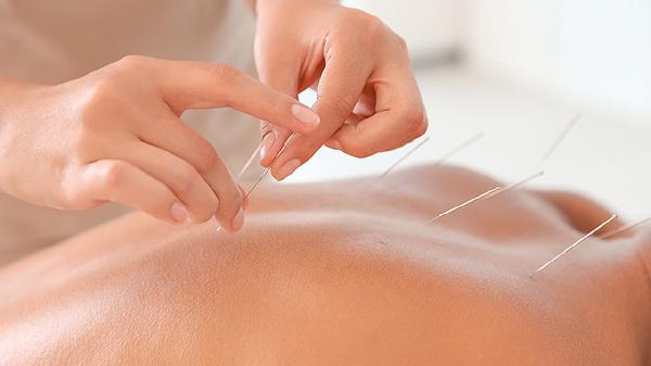 Can Acupuncture Help You Kick the Smoking Habit?
