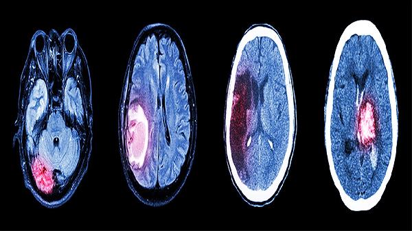 Brain Science Reveals: Book Lovers Have More Developed Language Learning Areas