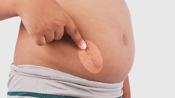 Want to lose belly fat fast? Try these 6 no-equipment exercises for men!